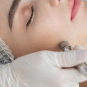 Microdermabrasion